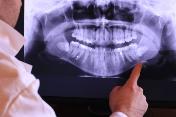 Best Emergency Denture Repair in Spring Hope, NC